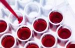 Биохимический анализ крови на мочевую кислоту и его расшифровка