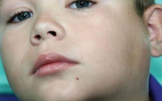 Анализ крови при лимфадените у ребенка