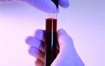 Что должен содержать нормальный анализ крови здорового человека