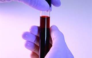 Каким должен быть правильный анализ крови в норме?