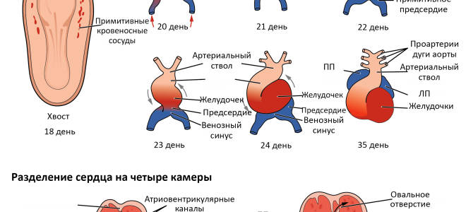 От чего появляется порок сердца у плода