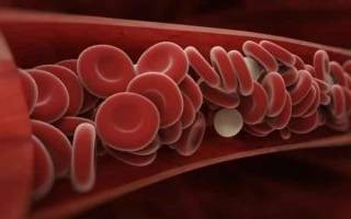 Лейкопения как повысить уровень лейкоцитов в крови