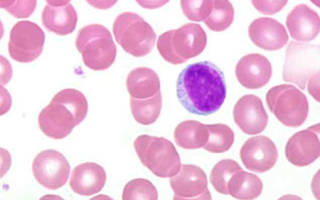 Понижены лимфоциты в крови: лечение лимфоцитопении, как повысить лимфоциты