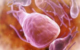 Антитела к лямблиям — Анализ крови на антитела к лямблиям, общие понятия