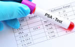 Исследование крови на ПСА свободный норма и возможные отклонения
