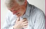 Инфаркт миокарда повторный задней стенки