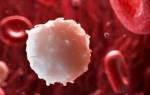 О чем говорят повышенные лейкоциты в анализе крови